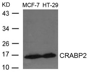 Anti-CRABP2 Antibody