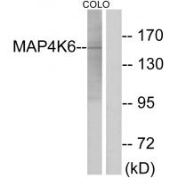 Anti-MAP4K6 Antibody