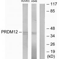 Anti-PRDM12 Antibody