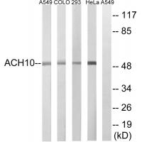 Anti-CHRNA10 Antibody