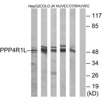 Anti-PPP4R1L Antibody