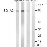 Anti-SLCO1A2 Antibody