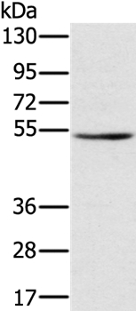Anti-TMPRSS2 Antibody