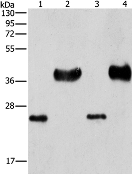 Anti-LIN28B Antibody