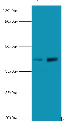 Anti-Lupus La protein Antibody