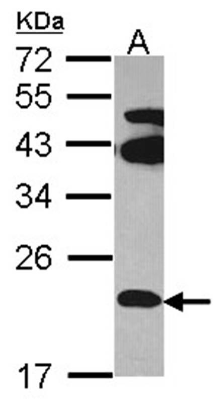 Anti-FAM18B Antibody