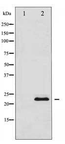 Anti-TIMP1 Antibody