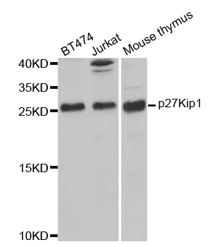 Anti-CDKN1B Antibody