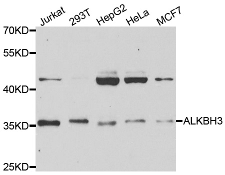 Anti-ALKBH3 Antibody