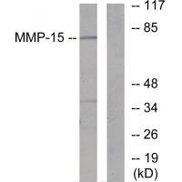 Anti-MMP-15 Antibody