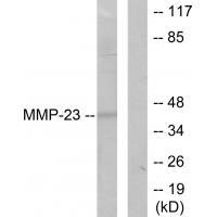 Anti-MMP-23 Antibody