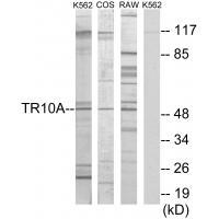 Anti-TR10A Antibody