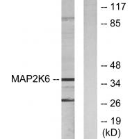 Anti-MAP2K6 Antibody