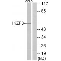 Anti-IKZF3 Antibody