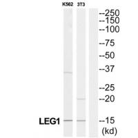 Anti-LGALS1 Antibody