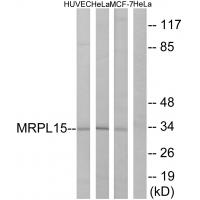 Anti-MRPL15 Antibody