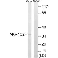 Anti-AKR1C2 Antibody