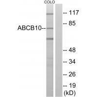 Anti-ABCB10 Antibody