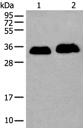 Anti-ATP1B2 Antibody