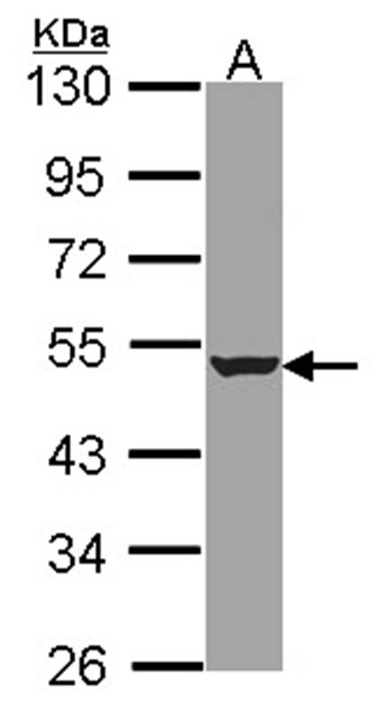 Anti-HADHB Antibody