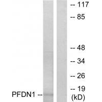 Anti-PFDN1 Antibody