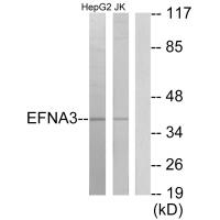 Anti-EFNA3 Antibody