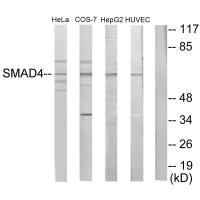 Anti-Smad4 Antibody