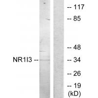 Anti-NR1I3 Antibody