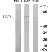 Anti-DBF4 Antibody