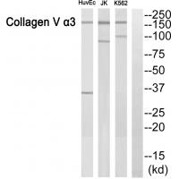 Anti-ACTN3 Antibody