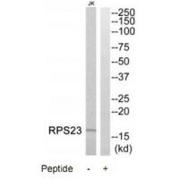 Anti-RPS23 Antibody