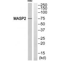 Anti-MASP2 Antibody