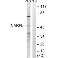 Anti-NARFL Antibody