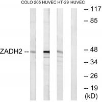 Anti-ZADH2 Antibody