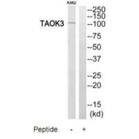 Anti-TAOK3 Antibody