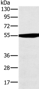 Anti-OXCT1 Antibody