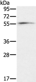 Anti-OXSR1 Antibody