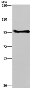 Anti-LLGL1 Antibody