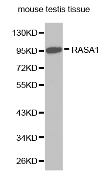 Anti-RASA1 Antibody