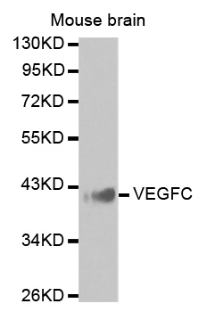 Anti-VEGFC Antibody