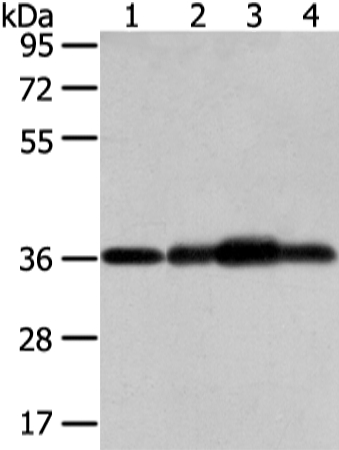 Anti-STX12 Antibody