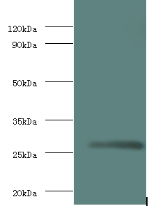 Anti-Matrix protein Antibody