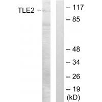 Anti-TLE2 Antibody