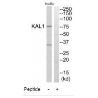 Anti-KAL1 Antibody