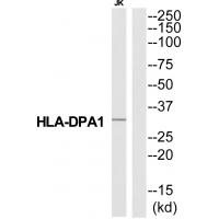 Anti-HA2Q Antibody