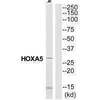 Anti-HXA5 Antibody