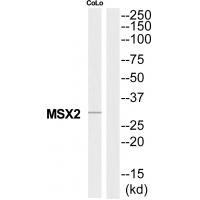 Anti-MSX2 Antibody