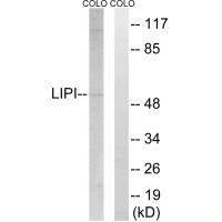 Anti-LIPI Antibody