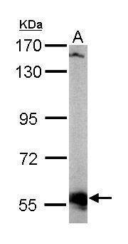 Anti-AKT3 Antibody