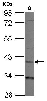 Anti-LRG1 Antibody